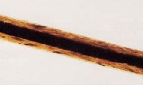 Forensic Science: Hair Evidence | Small Online Class for Ages 13-17