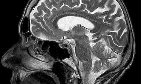 Brain Matters Neuroanatomy Part 2 4 Small Online Class For Ages
