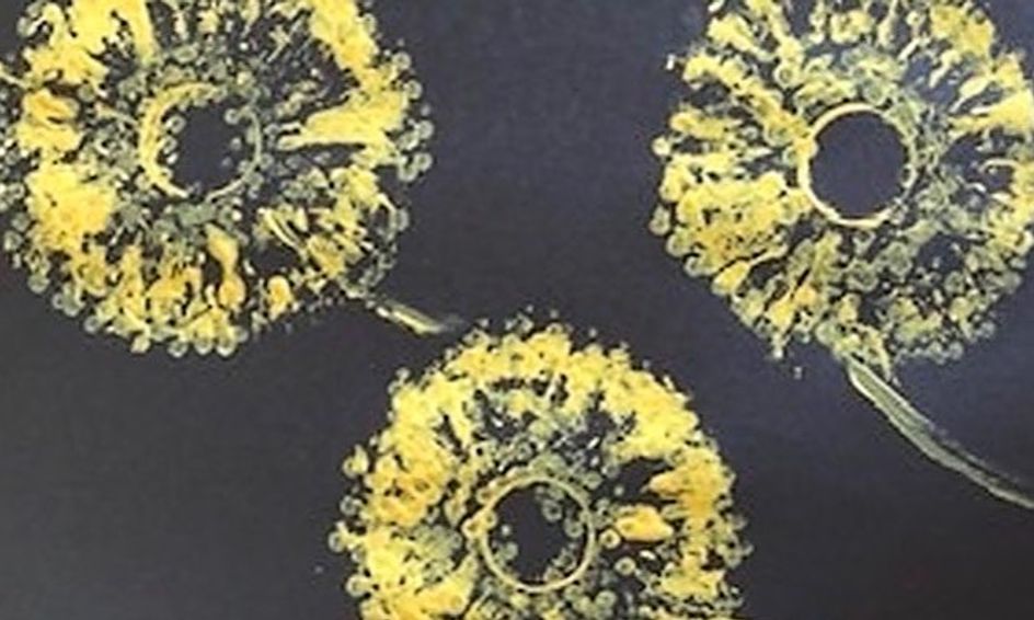 Dandelion Delight Small Online Class For Ages 6 9 Outschool