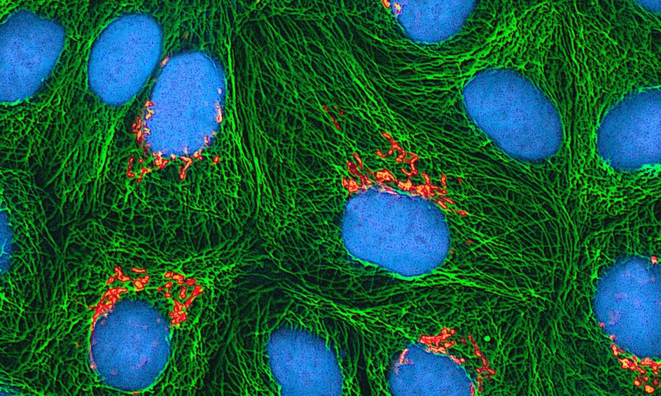 Cell Biology The Smaller Picture Small Online Class For Ages 13 15 Outschool
